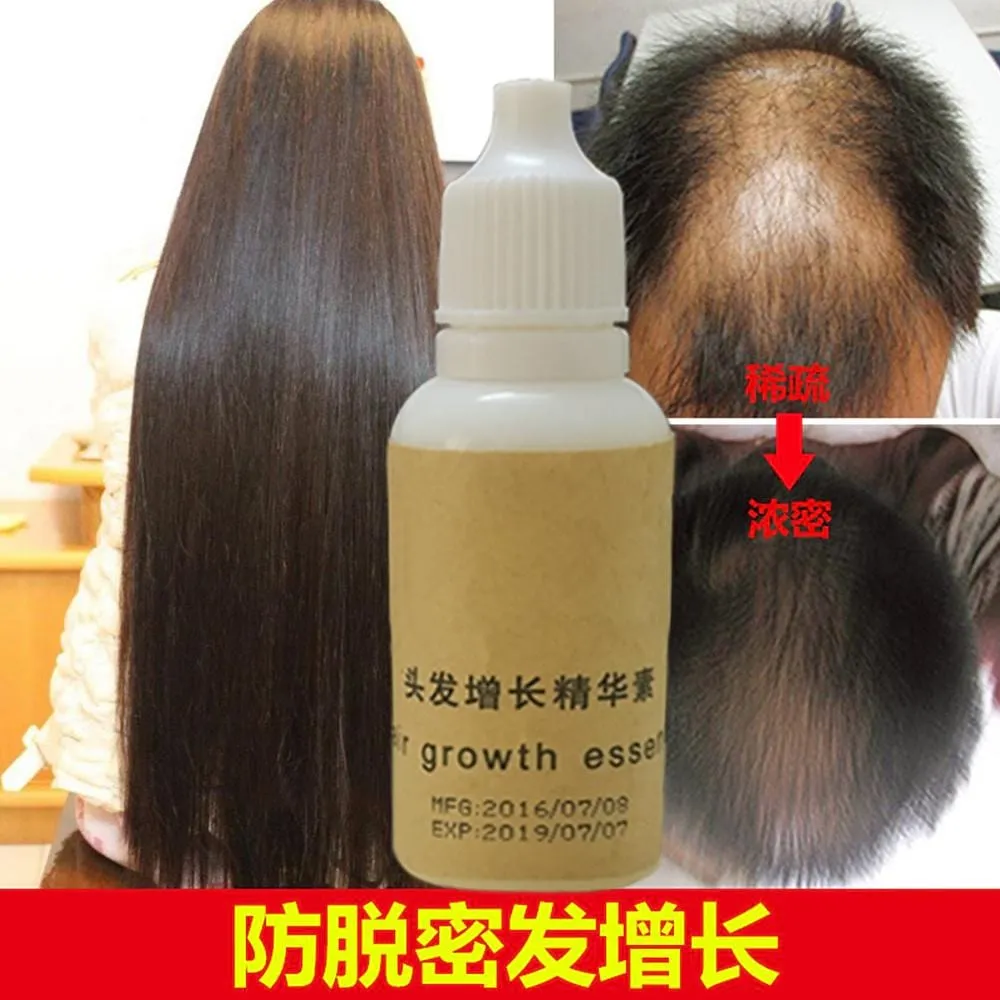 Andrea Hair Growth Professional Salon Hairstyles Keratin Hair Care Styling Anti Hair Loss dense sunburst better than TWNCE