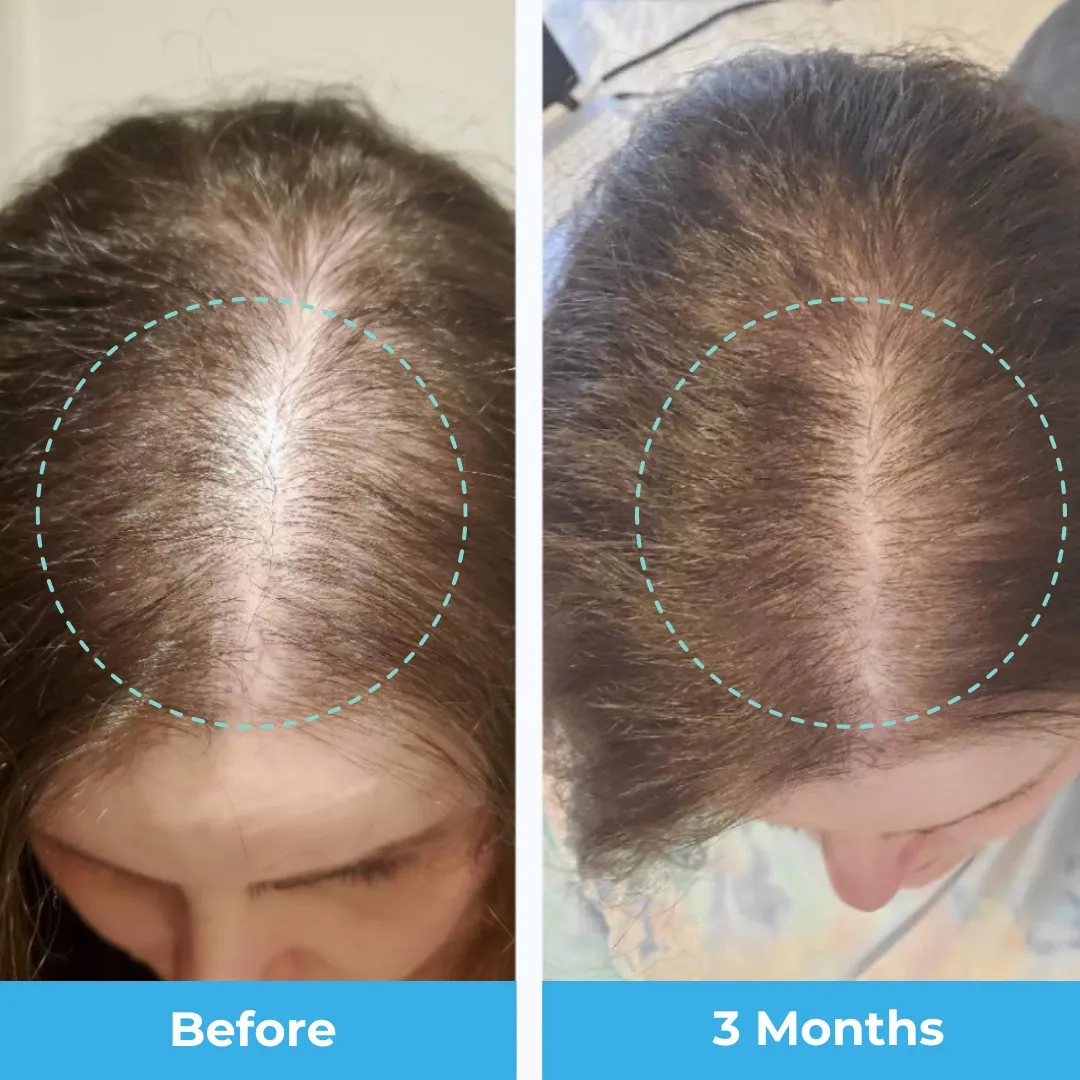 Postpartum Hair Vitamins